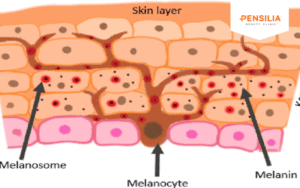 điều trị nám da do melanin