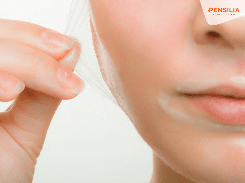 Liệu Chemical peel lợi hại ra sao?