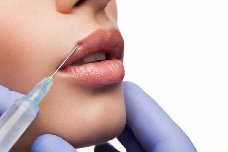 Ứng dụng của filler trong thẩm mỹ và làm đẹp