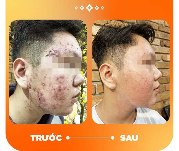 Chất lượng thương hiệu được khẳng định bằng kết quả thực tế