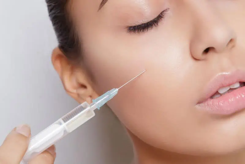 Tiêm Filler nâng cơ – phương pháp giúp làn da trẻ trung không tuổi