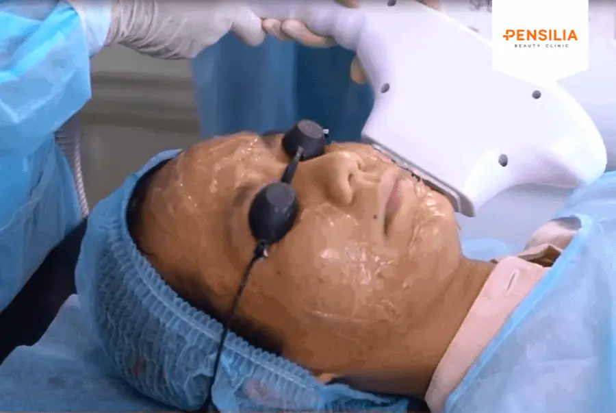 IPL trị sẹo