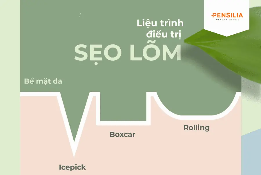 trị sẹo rỗ