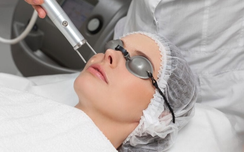 Nếu dùng thuốc không hiệu quả thì laser có thể điều trị viêm nang lông mãn tính