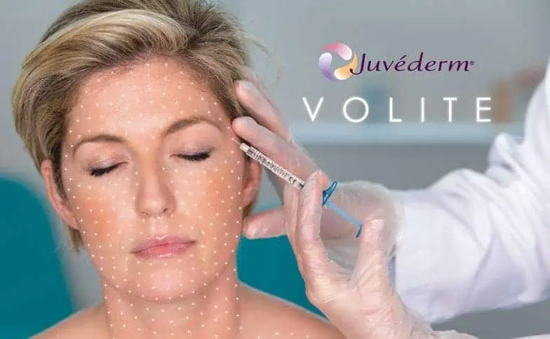 Công thức của JUVEDERM VOLITE