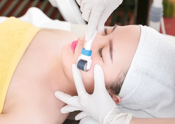 Phương pháp lăn kim được nhiều khách hàng tin dùng