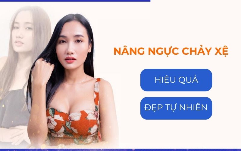 Nâng ngực chảy xệ Pensilia