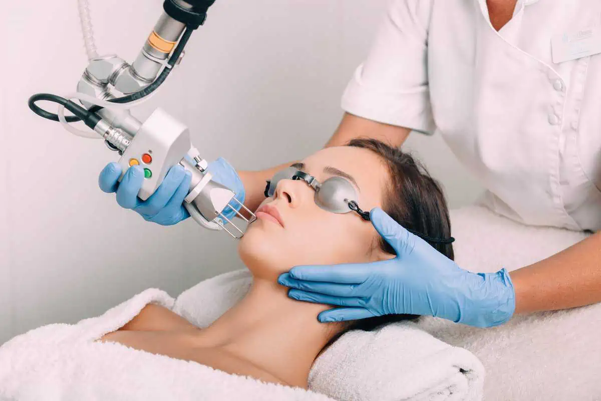 Fractional Laser CO2 có khả năng điều trị sẹo rất tốt