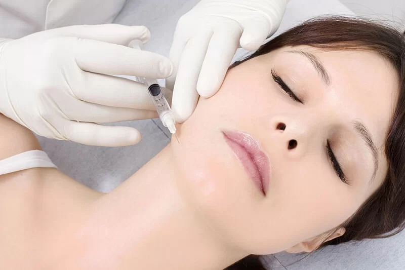 Tiêm cằm bằng filler Juvederm cằm, giảm độ hô vùng miệng