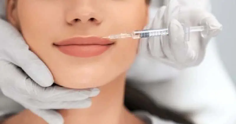 Tiêm filler môi sẽ cân chỉnh được dáng môi mất cân đối