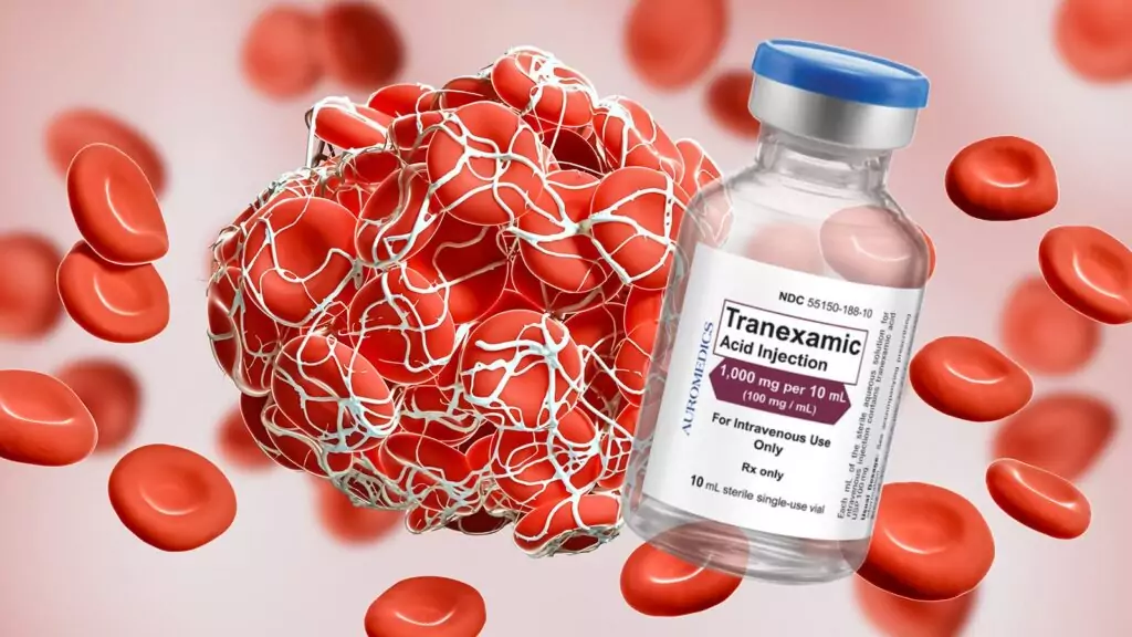 Tranexamic acid là gì?