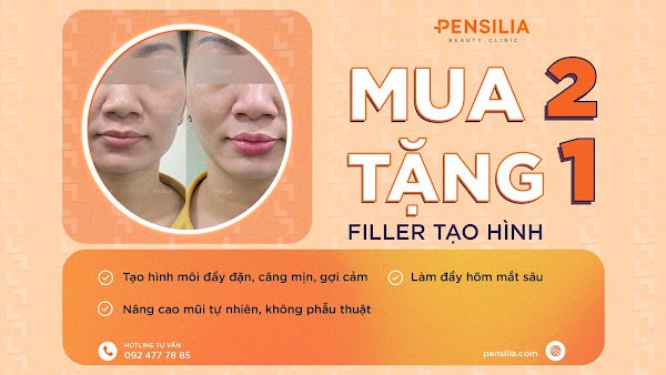 Chương trình ưu đãi: Mua 2 tặng 1 tiêm filler tạo hình