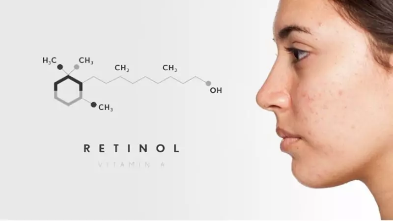 Retinol có trị mụn được không