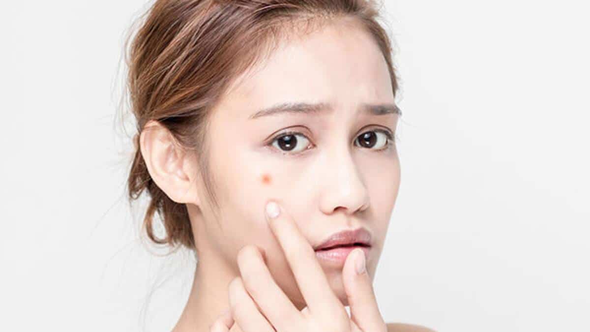 Các phương pháp điều trị mụn chuyên sâu tại phòng khám