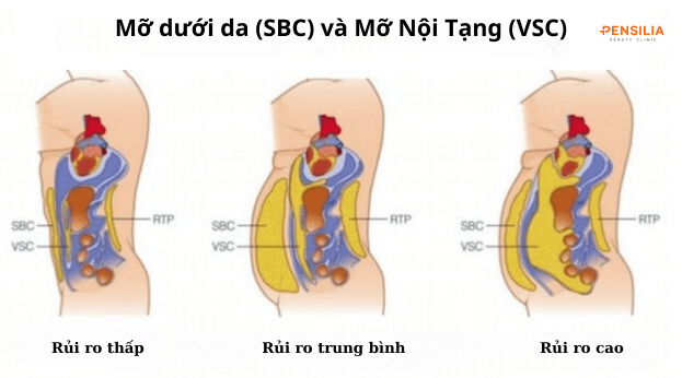 Mỡ nội tạng ảnh hưởng nhiều đến sức khỏe