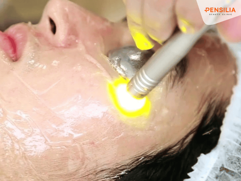 Công nghệ laser đồng trắng sáng da