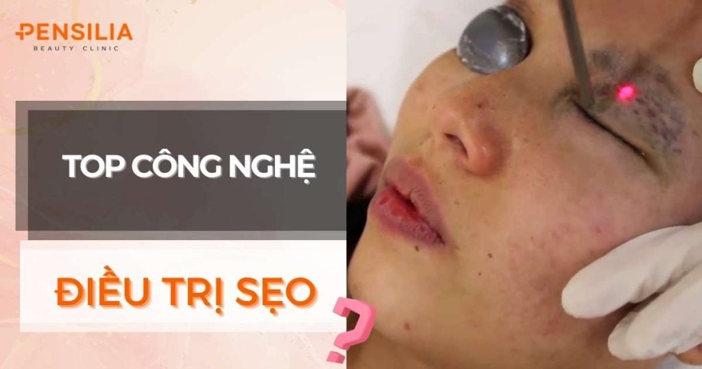 top công nghệ điều trị sẹo