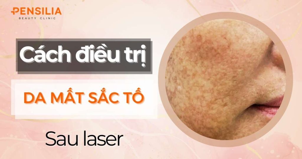 Cách điều trị mất sắc tố da sau laser hiệu quả nhất hiện nay