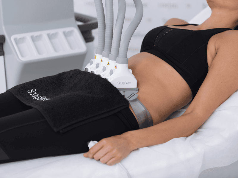 Hủy mỡ không phẫu thuật với laser Sculpsure