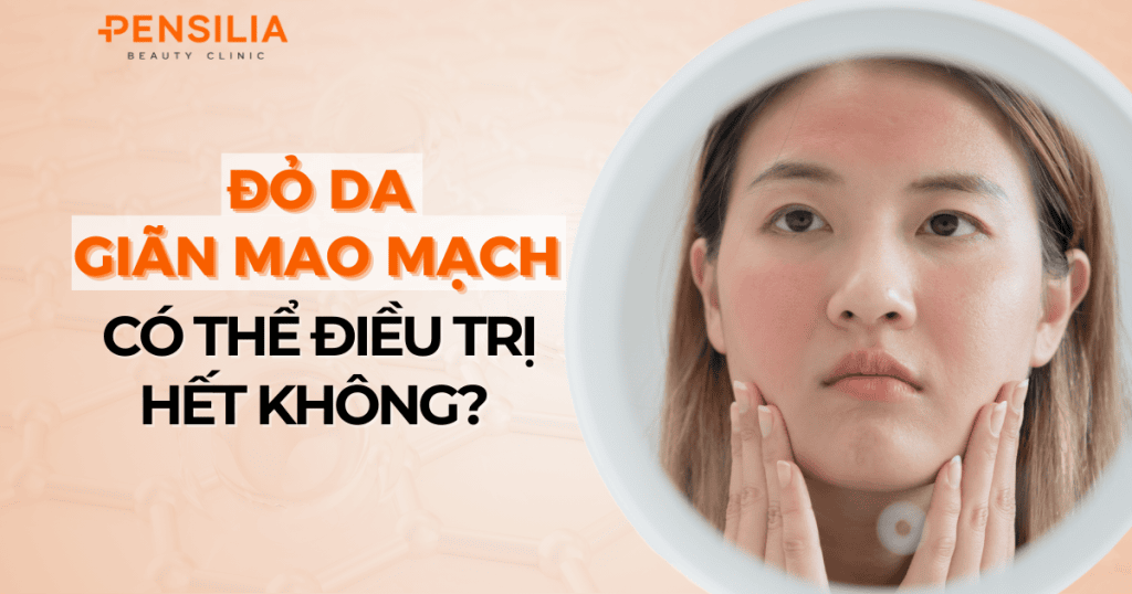 Đỏ da, giãn mao mạch có thể điều trị hết không