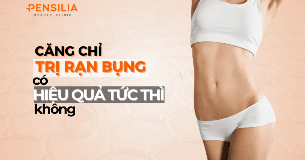 Căng chỉ trị rạn bụng có hiệu quả tức thì không