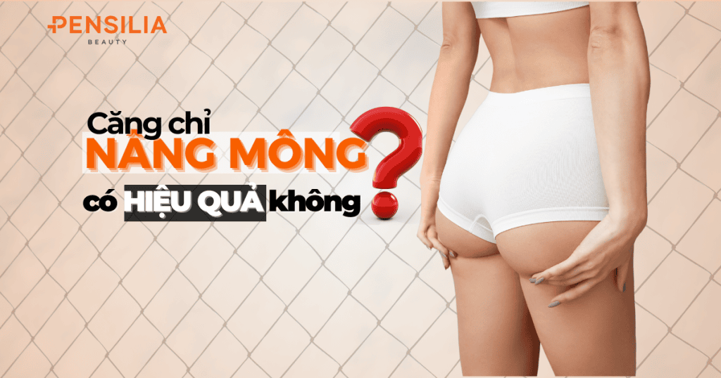 Căng chỉ nâng mông có hiệu quả không