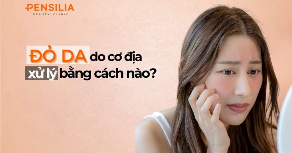 Đỏ da do cơ địa xử lý bằng cách nào?