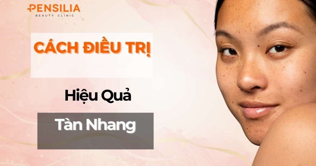 Nguyên nhân và cách điều trị tàn nhang hiệu quả