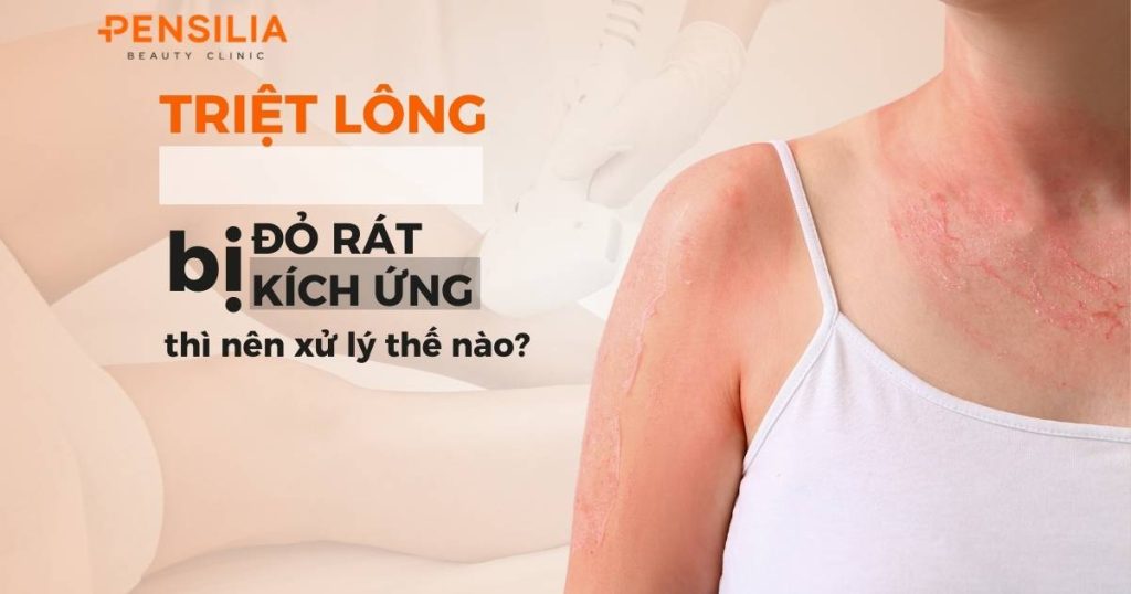 Triệt lông bị đỏ rát kích ứng thì nên xử lý thế nào?