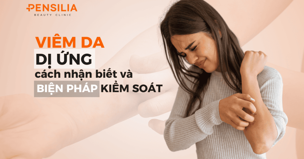 Viêm da dị ứng