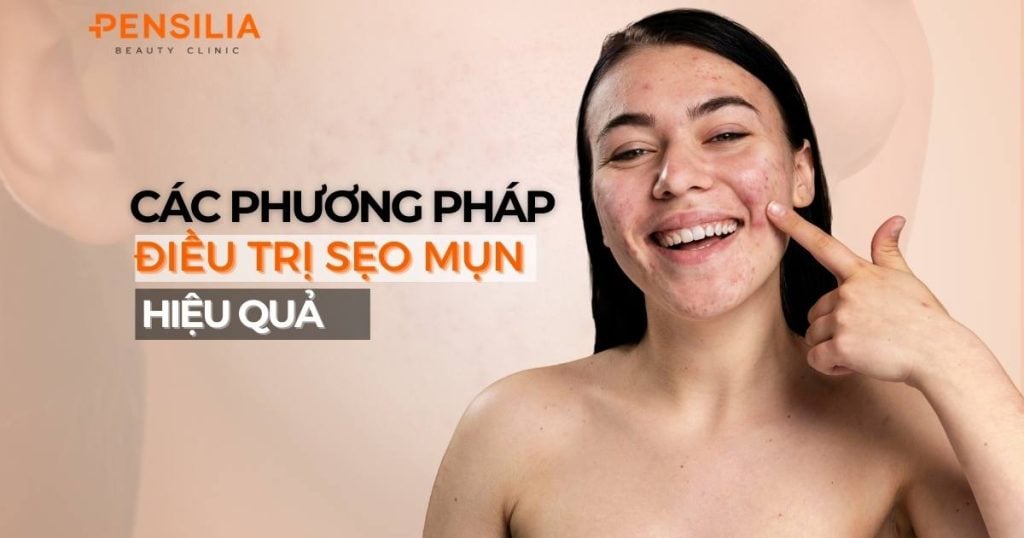 Các phương pháp điều trị sẹo mụn hiệu quả