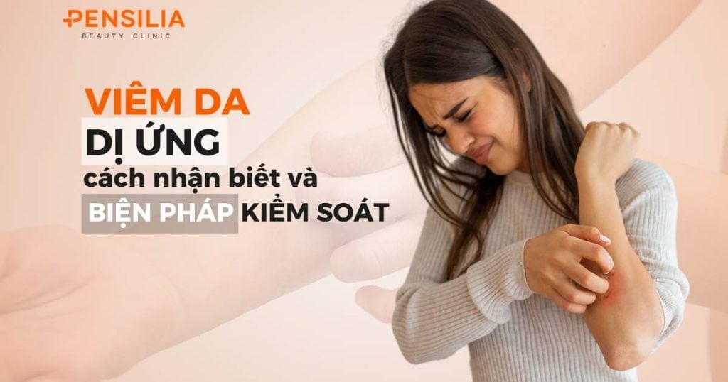 Viêm da dị ứng: cách nhận biết và biện pháp kiểm soát