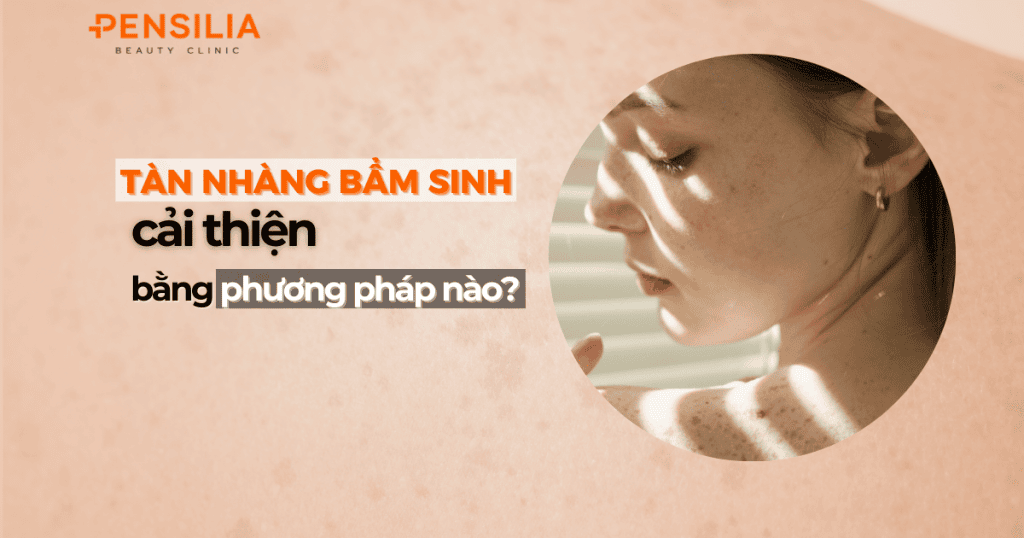 Tàn nhang bẩm sinh cải thiện bằng cách nào