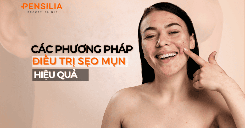 Phương pháp điều trị sẹo mụn hiệu quả