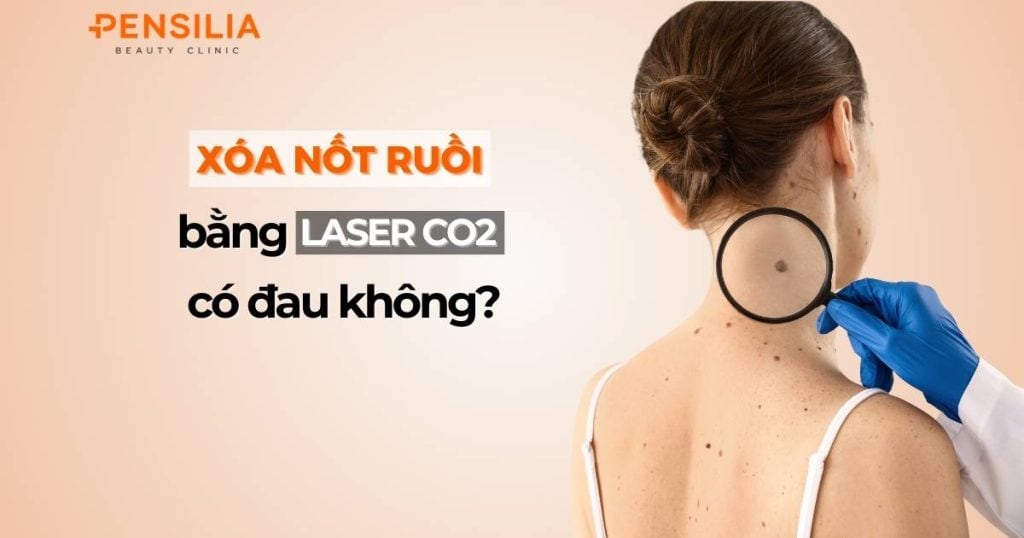 Xóa nốt ruồi bằng Laser CO2 có đau không?