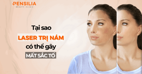 Tại sao laser trị nám có thể gây mất sắc tố da?