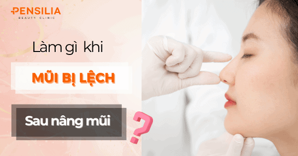 Làm gì khi mũi bị lệch sau phẫu thuật nâng mũi?