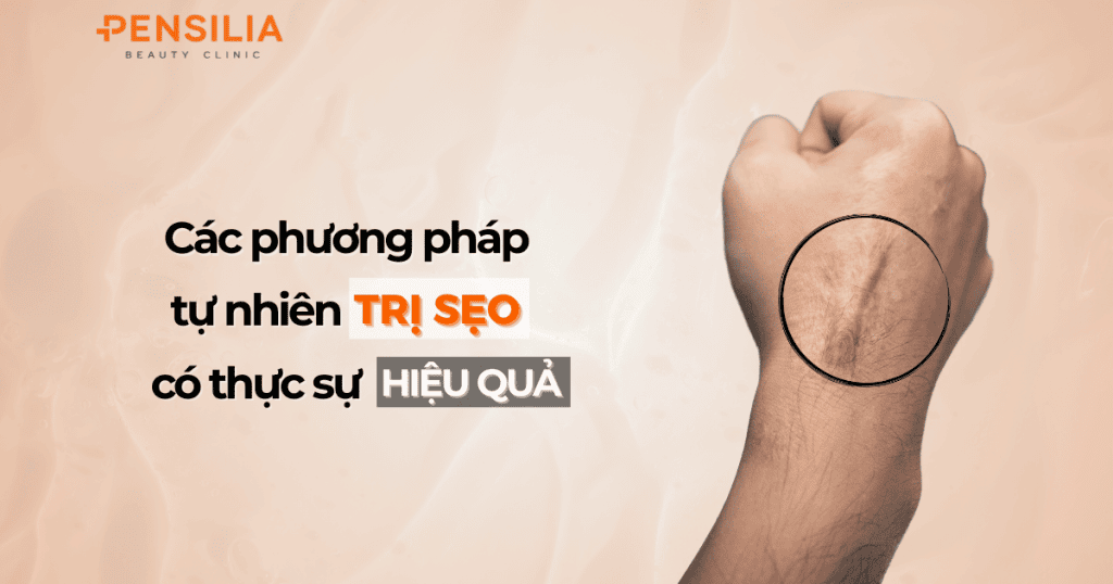 Các phương pháp tự nhiên trị sẹo có thực sự hiệu quả