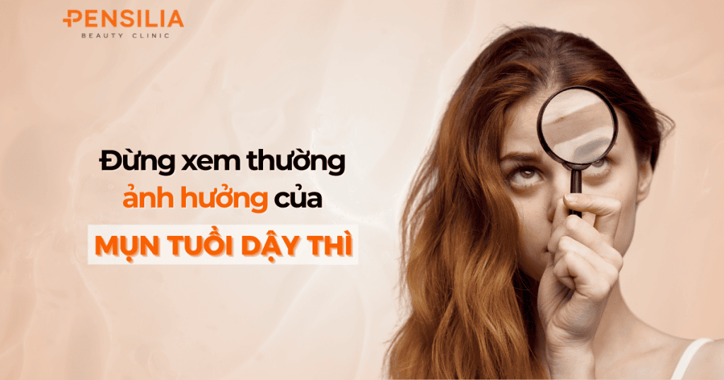 Đừng xem thường ảnh hưởng của mụn tuổi dậy thì