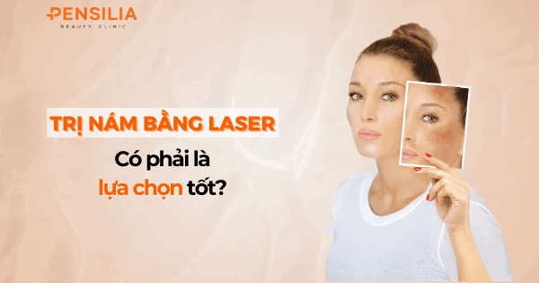 Trị nám da bằng laser: Có phải là lựa chọn tốt nhất?