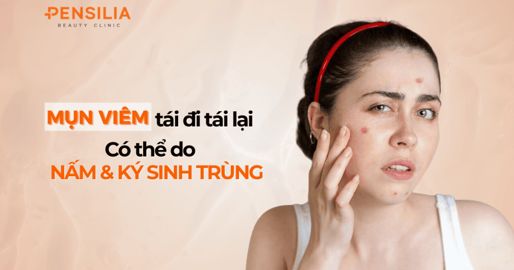 Mụn viêm tái đi tái lại Có thể do nấm và ký sinh trùng