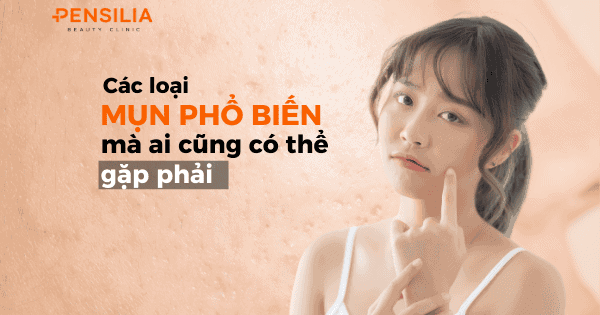 Các loại mụn phổ biến mà ai cũng có thể gặp phải