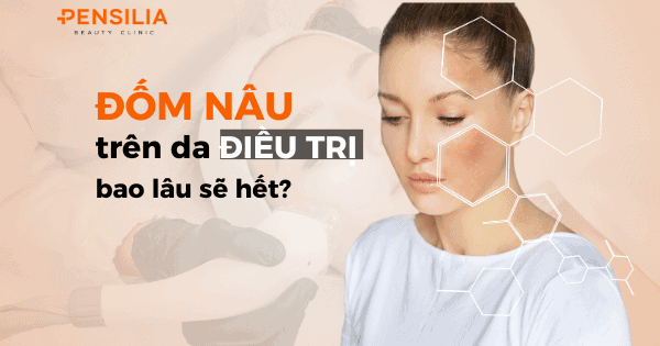 Đốm nâu