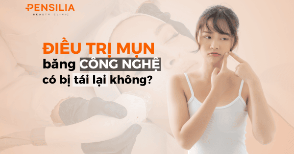 Điều trị mụn bằng công nghệ có bị tái lại không?