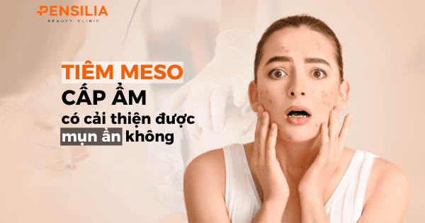 Tiêm meso cấp ẩm có cải thiện được mụn ẩn không