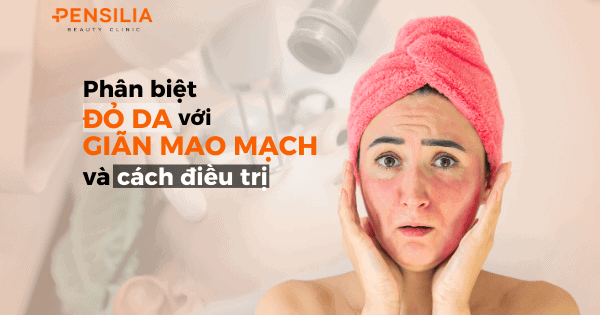 Phân biệt giãn mao mạch với đỏ da và cách điều trị