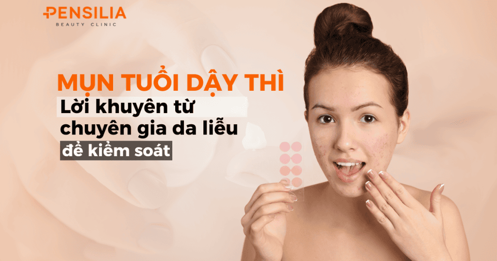 Mụn tuổi dậy thì