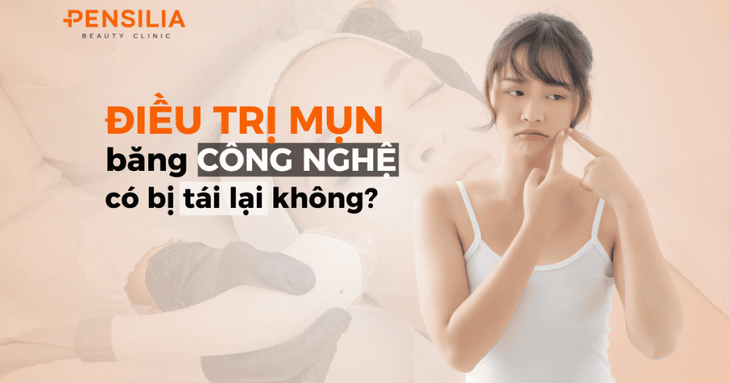 Điều trị mụn bằng công nghệ có bị tái lại không