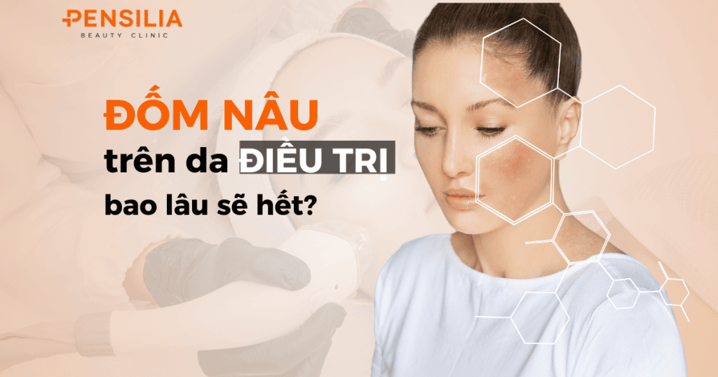 Đốm nâu trên da điều trị bao lâu sẽ hết?