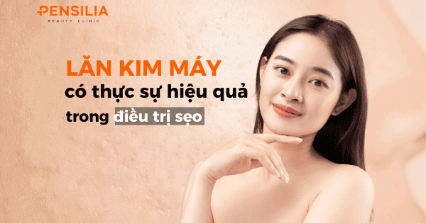 Lăn kim máy có thực sự hiệu quả trong điều trị sẹo?